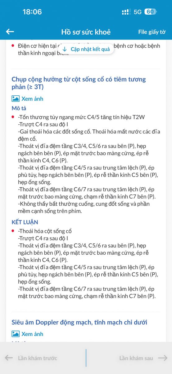 Thoát vị đĩa đệm cổ